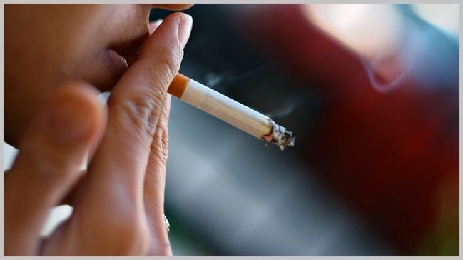 smoking as the cause of varicose veins