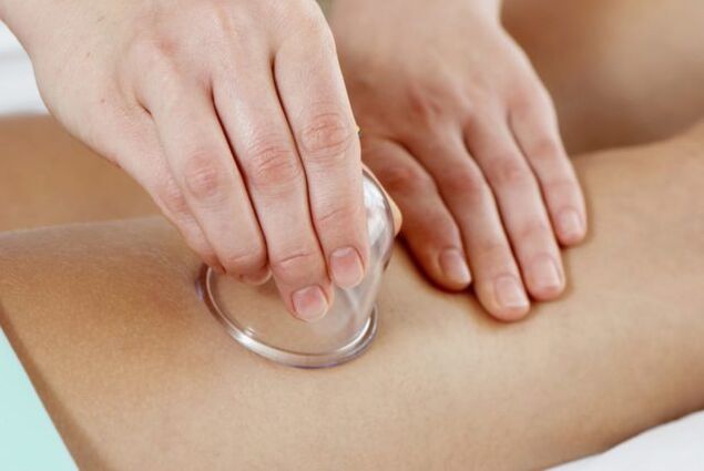 cupping massage varicose veins
