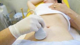 prichiny-varikoza-ultrasound