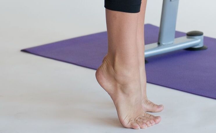 exercise to prevent varicose veins