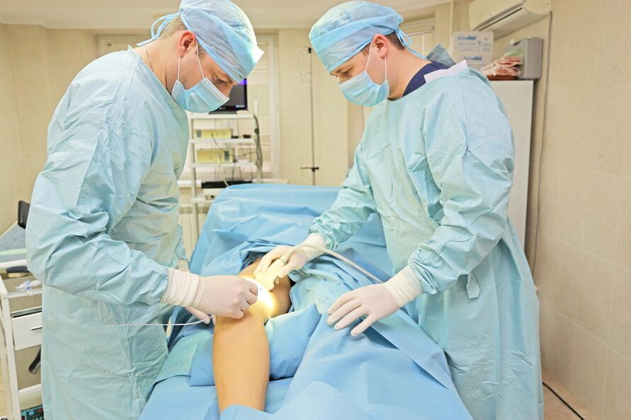 surgery to treat pelvic varicose veins