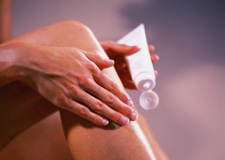 creams and ointments for treating varicose veins