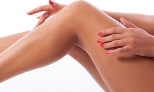 the cause of varicose veins in women